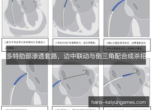 多特肋部渗透套路,边中联动与倒三角配合成杀招 多特肋部渗透套路,边中联动与倒三角配合成杀招